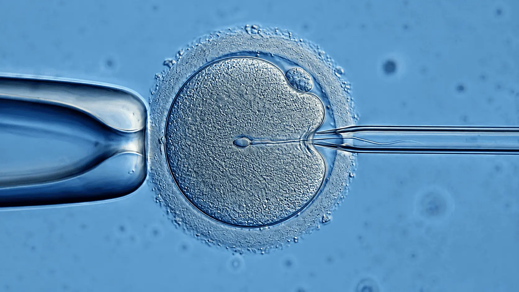Fécondation in vitro